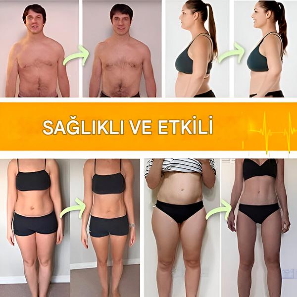 Yağ ve selülit azaltma kemeri | SHAPEUP